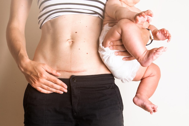 Hồi Phục Sau Sinh Mổ: 7 Bước Chăm Sóc Vết Thương Đúng Cách Tại Nhà